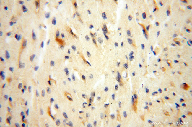 VASP Antibody in Immunohistochemistry (Paraffin) (IHC (P))