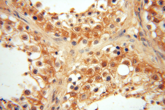 VASP Antibody in Immunohistochemistry (Paraffin) (IHC (P))