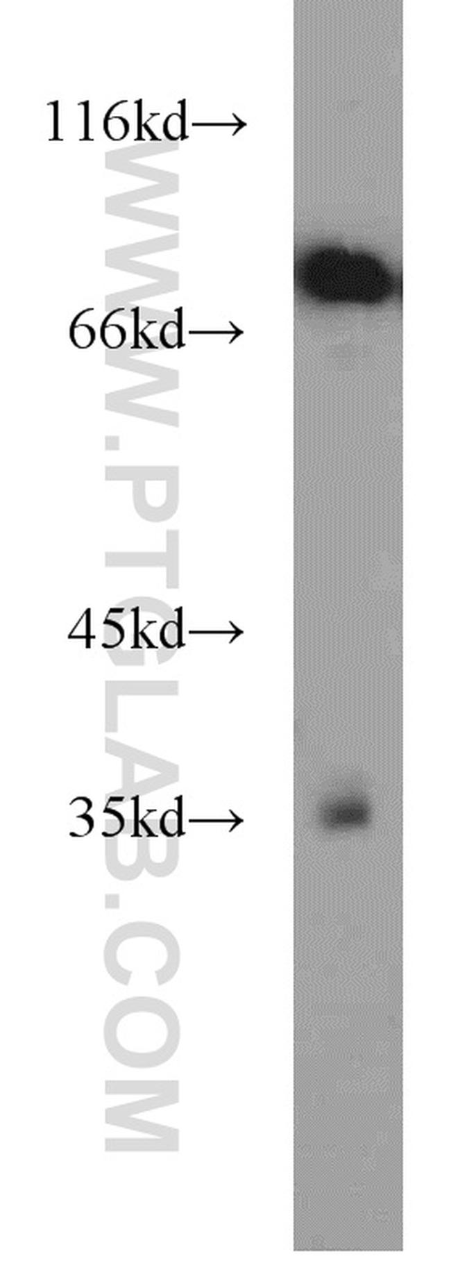SYVN1 Antibody in Western Blot (WB)