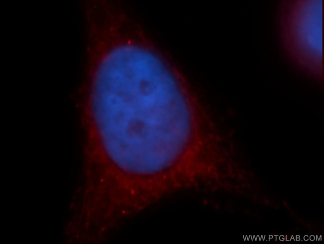 Cryptochrome 1 Antibody in Immunocytochemistry (ICC/IF)