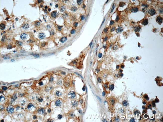 Cryptochrome 1 Antibody in Immunohistochemistry (Paraffin) (IHC (P))