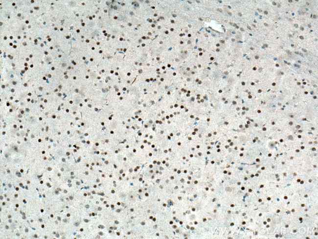 Cryptochrome 1 Antibody in Immunohistochemistry (Paraffin) (IHC (P))