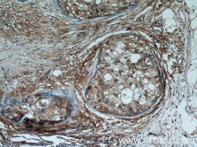 Cryptochrome 1 Antibody in Immunohistochemistry (Paraffin) (IHC (P))