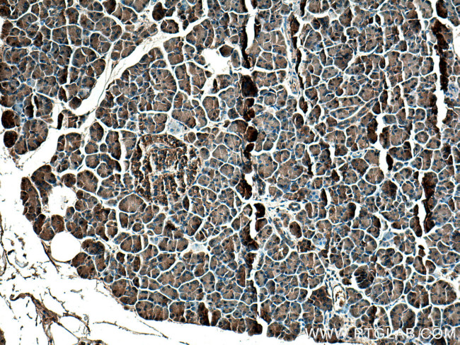 SPINK1 Antibody in Immunohistochemistry (Paraffin) (IHC (P))