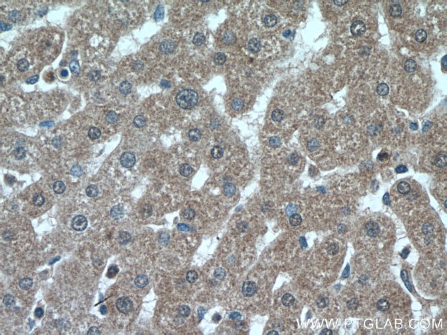 PPP2CA Antibody in Immunohistochemistry (Paraffin) (IHC (P))