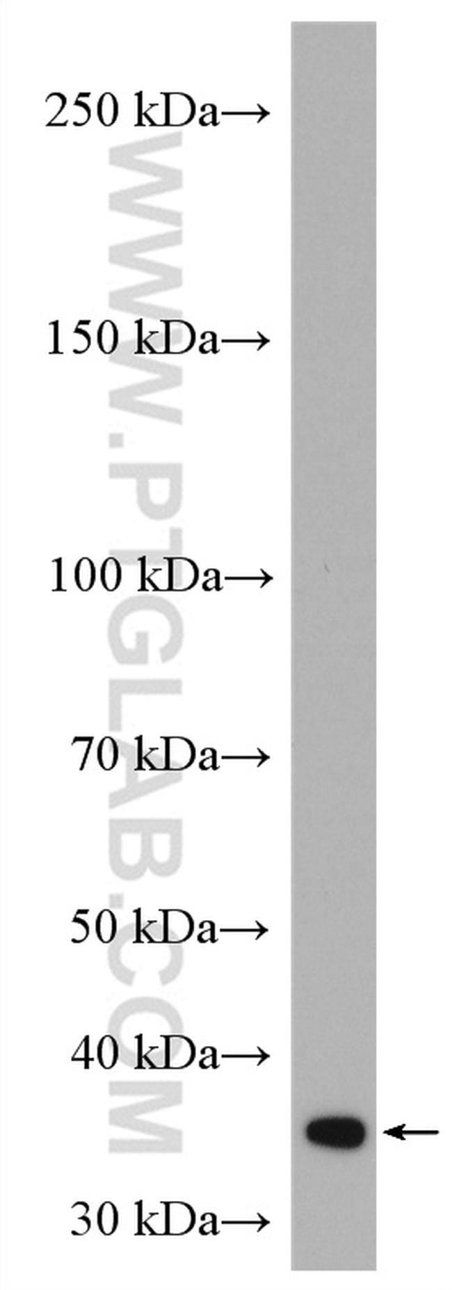 PPP2CA Antibody in Western Blot (WB)