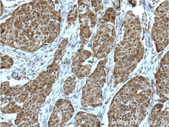 PIAS3 Antibody in Immunohistochemistry (Paraffin) (IHC (P))