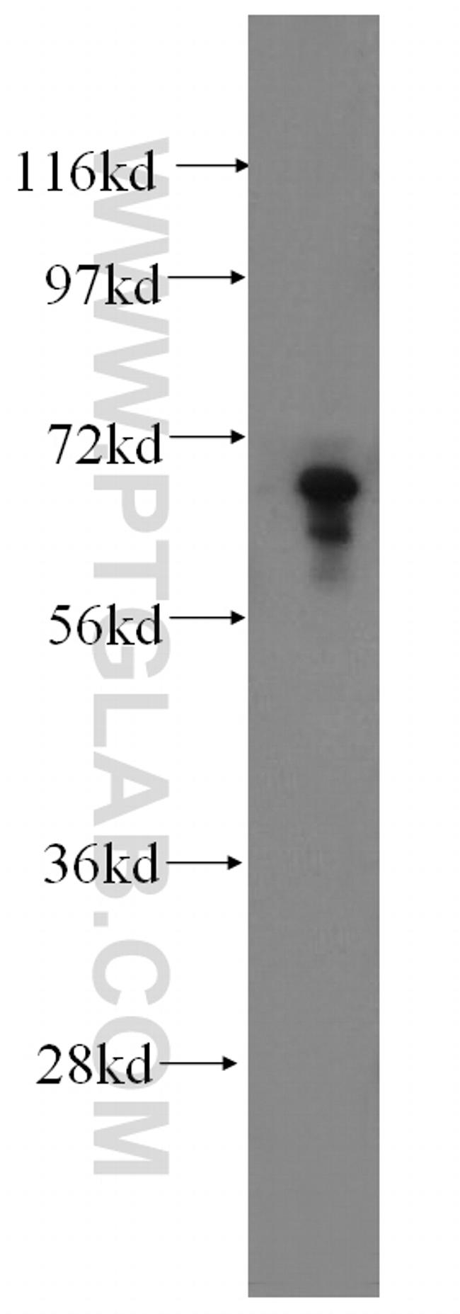 PIAS3 Antibody in Western Blot (WB)