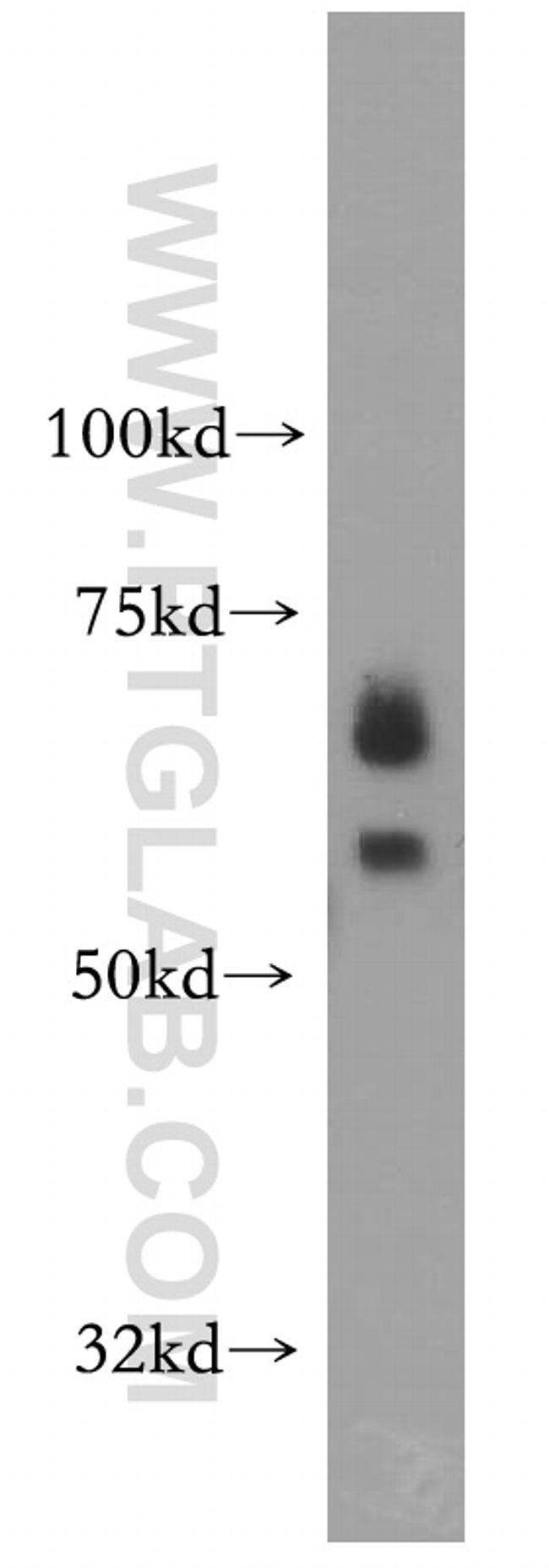 PIAS3 Antibody in Western Blot (WB)