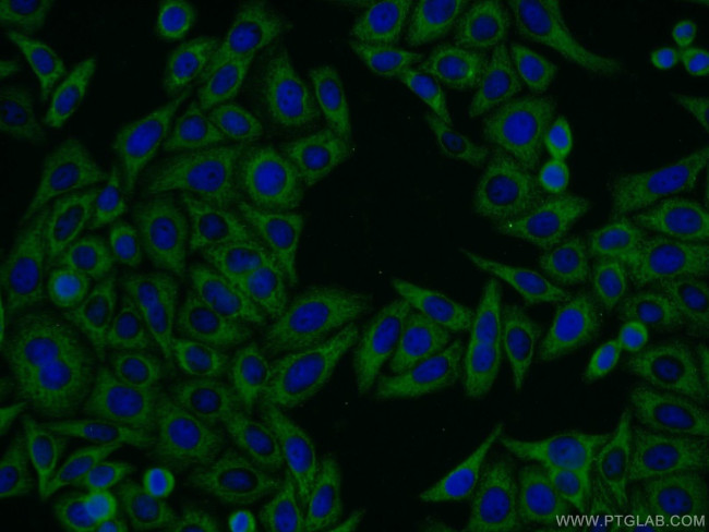 MTMR4 Antibody in Immunocytochemistry (ICC/IF)