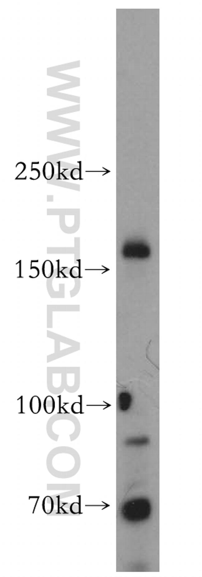 MTMR4 Antibody in Western Blot (WB)