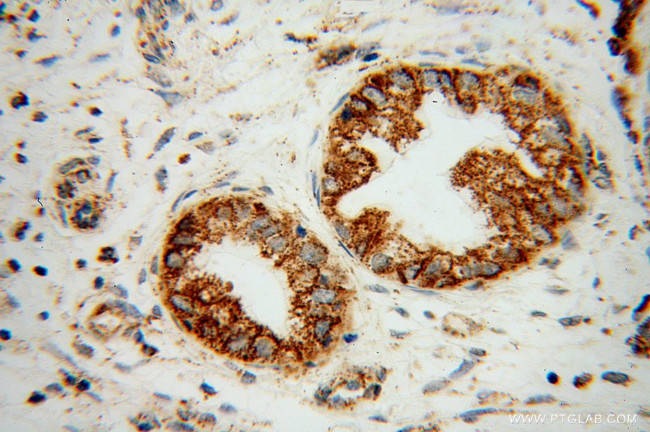 B3GALT4 Antibody in Immunohistochemistry (Paraffin) (IHC (P))