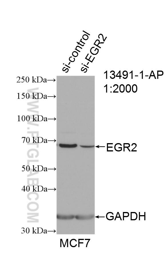 EGR2 Antibody in Western Blot (WB)