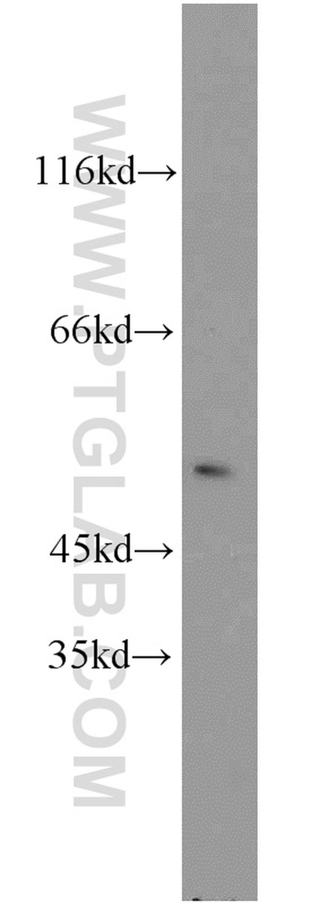 EGR2 Antibody in Western Blot (WB)