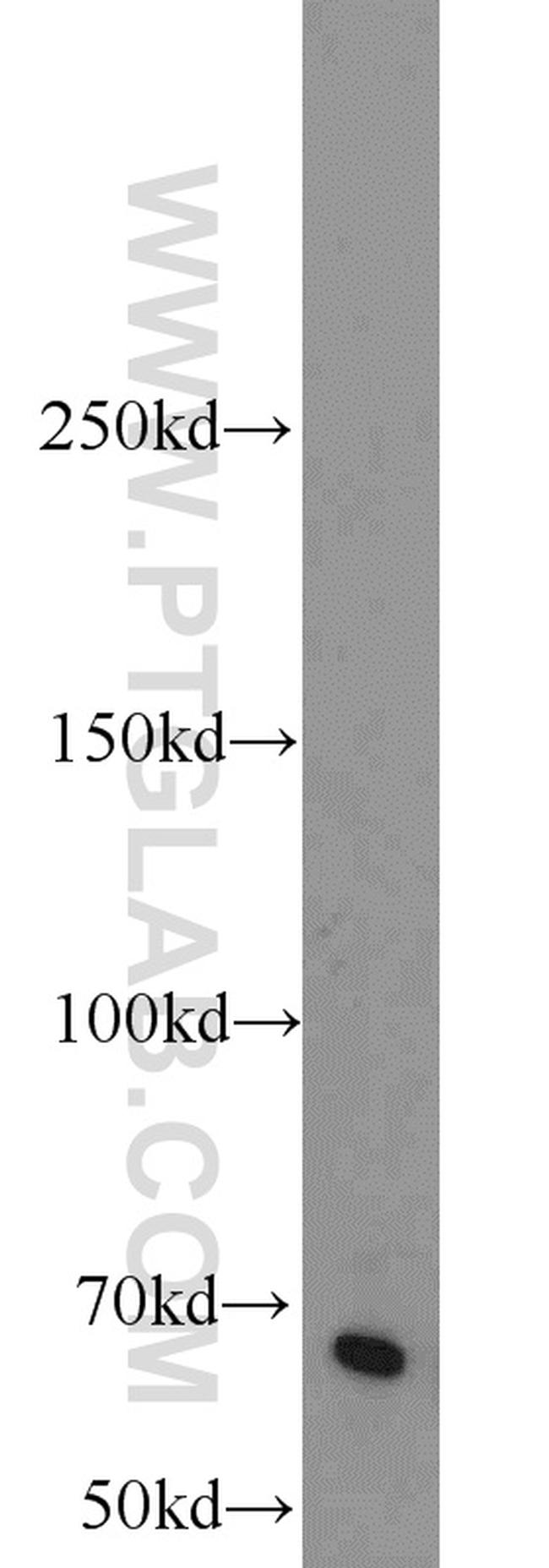 EGR2 Antibody in Western Blot (WB)