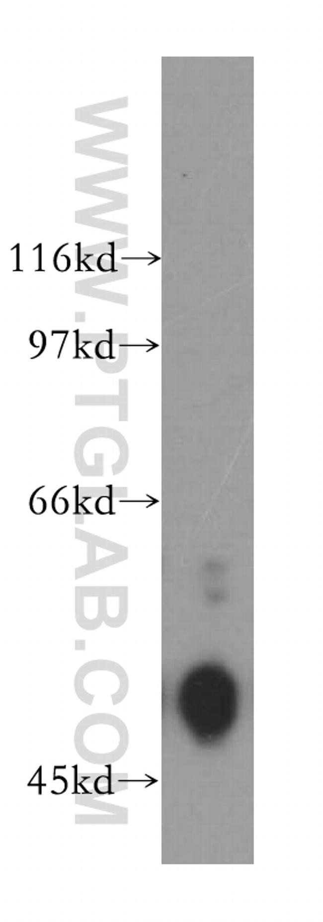 EGR2 Antibody in Western Blot (WB)