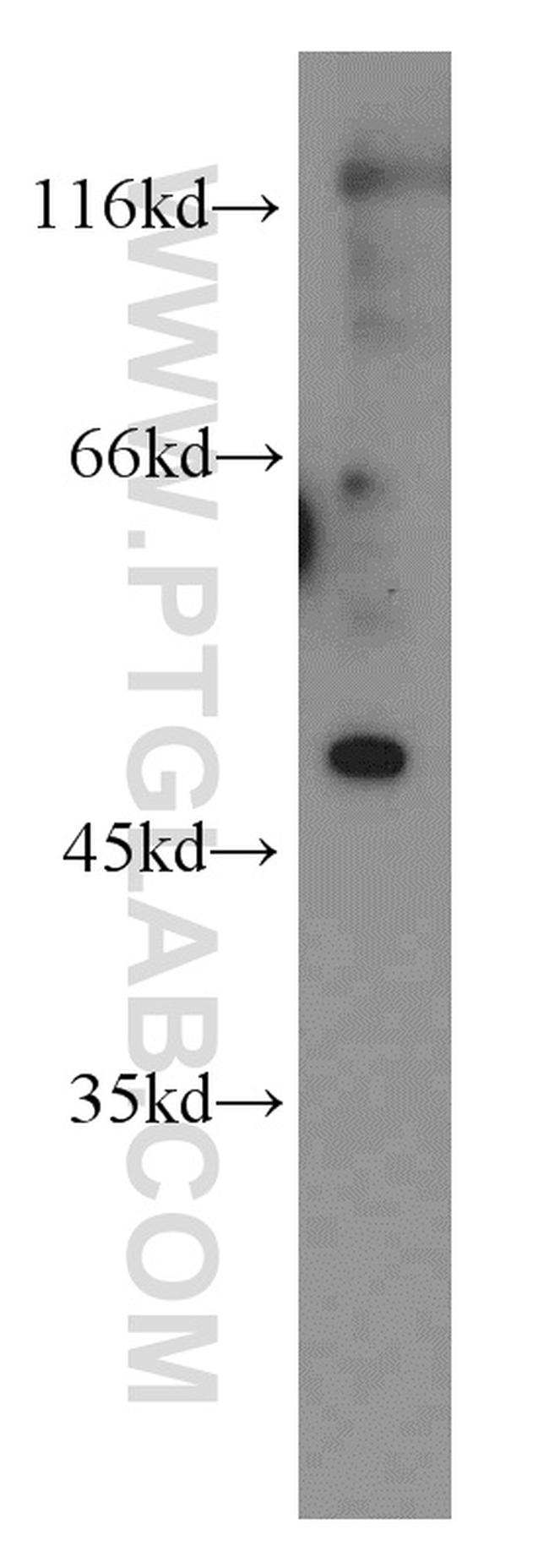 EGR2 Antibody in Western Blot (WB)