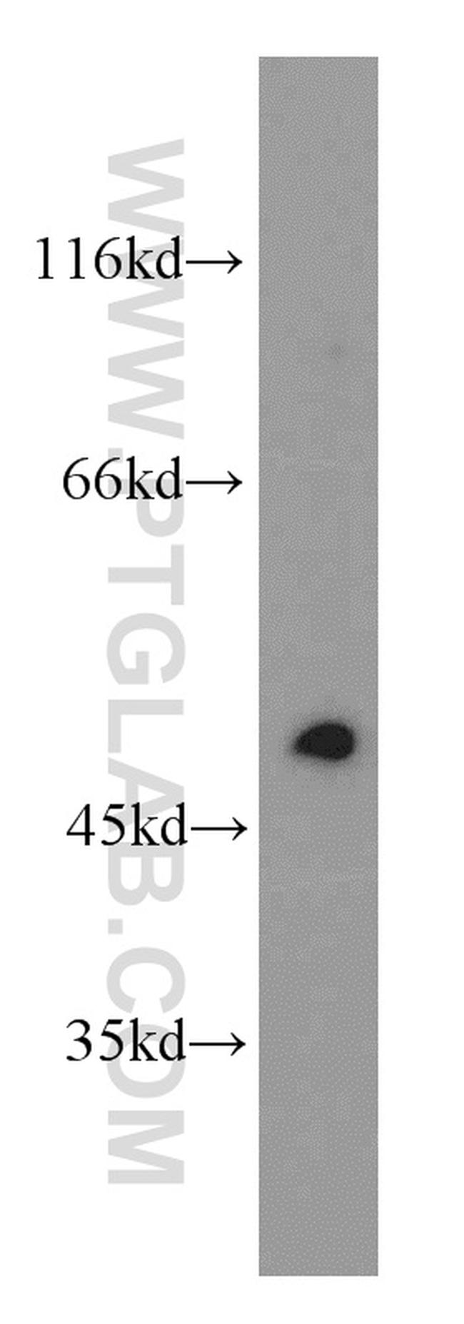 EGR2 Antibody in Western Blot (WB)