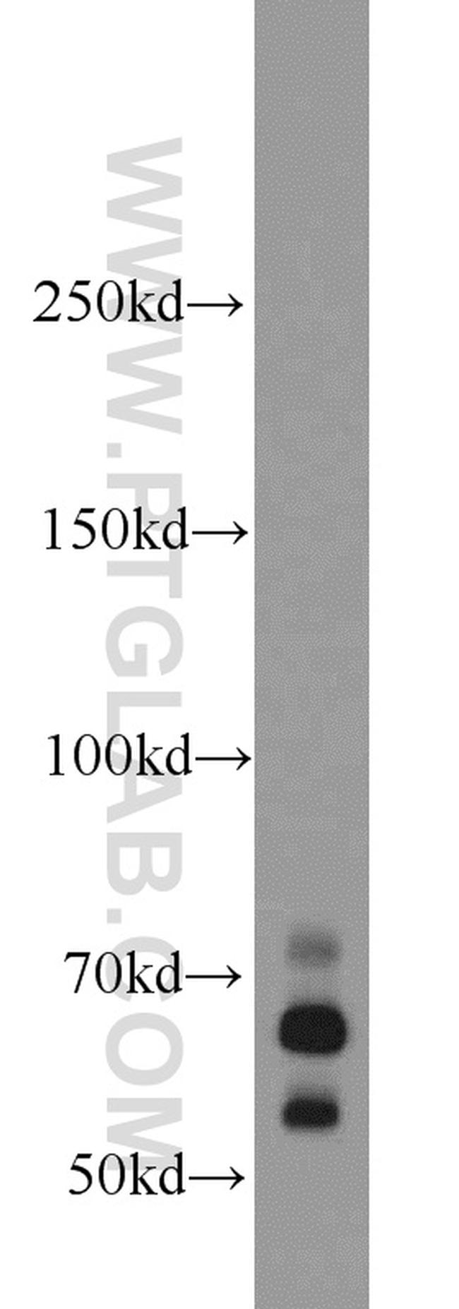 EGR2 Antibody in Western Blot (WB)