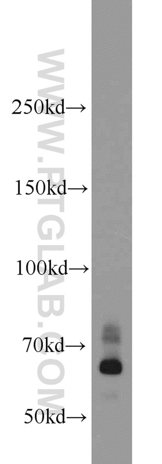 EGR2 Antibody in Western Blot (WB)