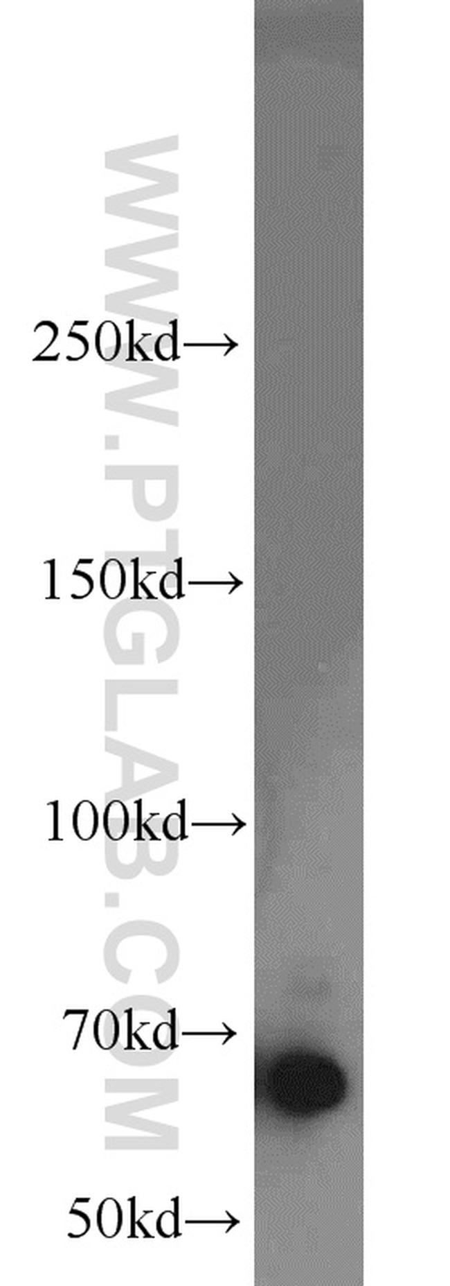 EGR2 Antibody in Western Blot (WB)