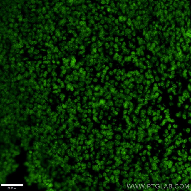 OTX2 Antibody in Immunohistochemistry (PFA fixed) (IHC (PFA))