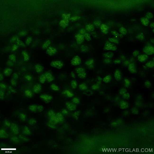 OTX2 Antibody in Immunohistochemistry (PFA fixed) (IHC (PFA))