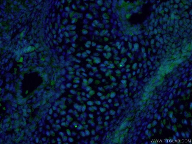 OTX2 Antibody in Immunohistochemistry (PFA fixed) (IHC (PFA))