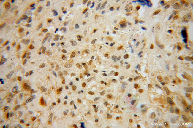 OTX2 Antibody in Immunohistochemistry (Paraffin) (IHC (P))