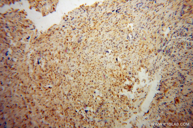 OTX2 Antibody in Immunohistochemistry (Paraffin) (IHC (P))