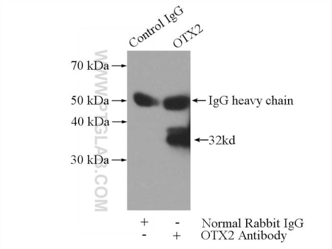 OTX2 Antibody in Immunoprecipitation (IP)