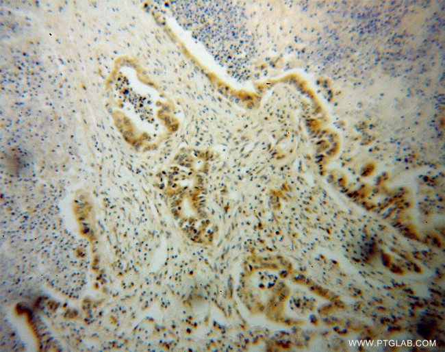 NGB Antibody in Immunohistochemistry (Paraffin) (IHC (P))