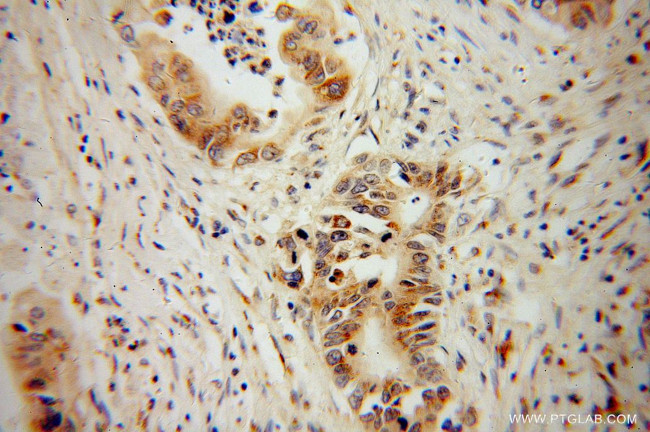 NGB Antibody in Immunohistochemistry (Paraffin) (IHC (P))