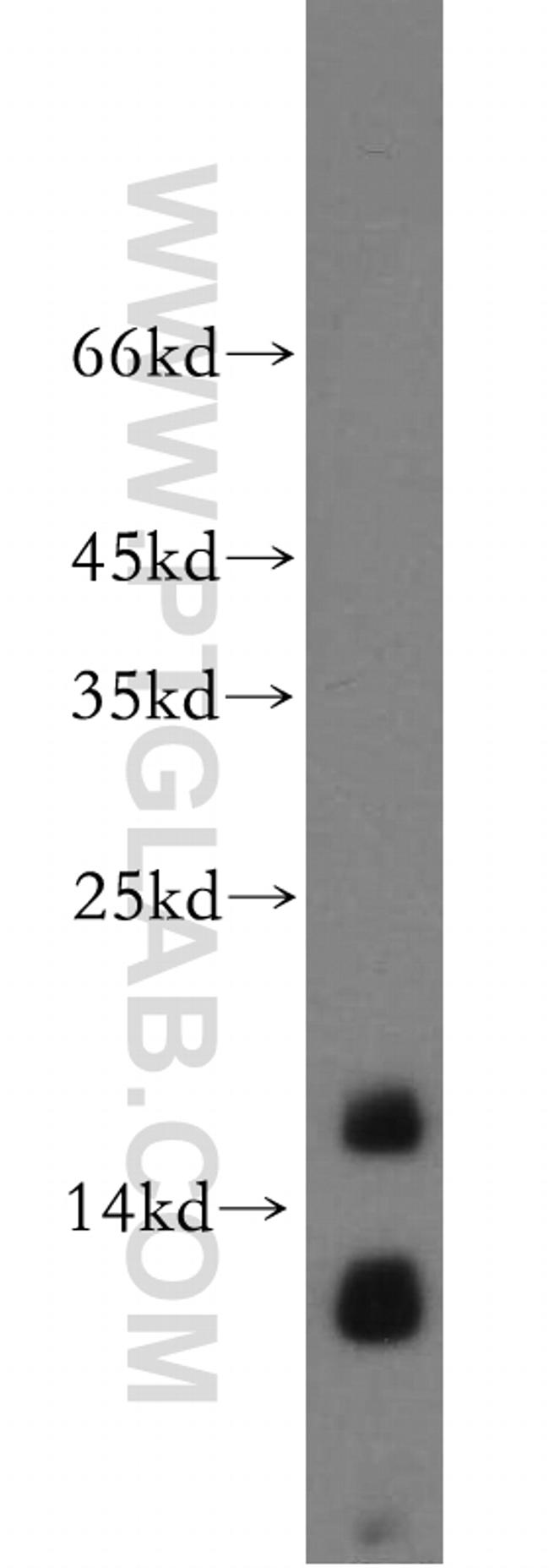 NGB Antibody in Western Blot (WB)