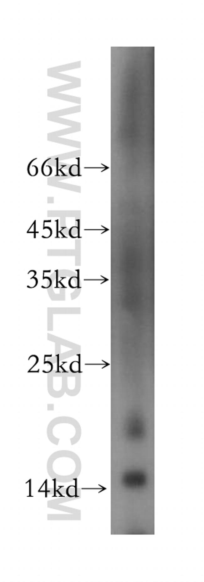 NGB Antibody in Western Blot (WB)