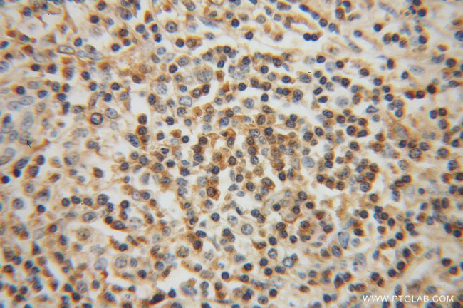 RIAM Antibody in Immunohistochemistry (Paraffin) (IHC (P))