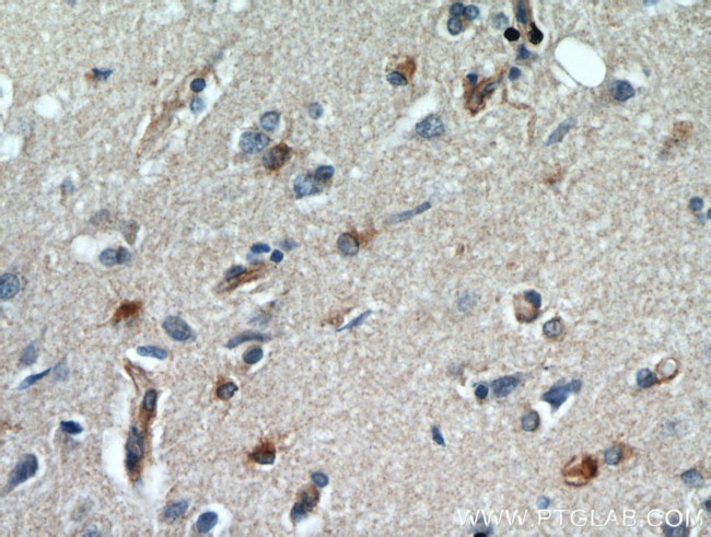 GPX7 Antibody in Immunohistochemistry (Paraffin) (IHC (P))