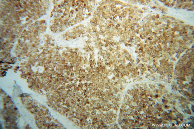 GPX7 Antibody in Immunohistochemistry (Paraffin) (IHC (P))