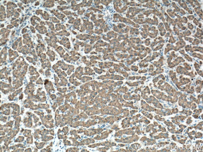 GPX7 Antibody in Immunohistochemistry (Paraffin) (IHC (P))