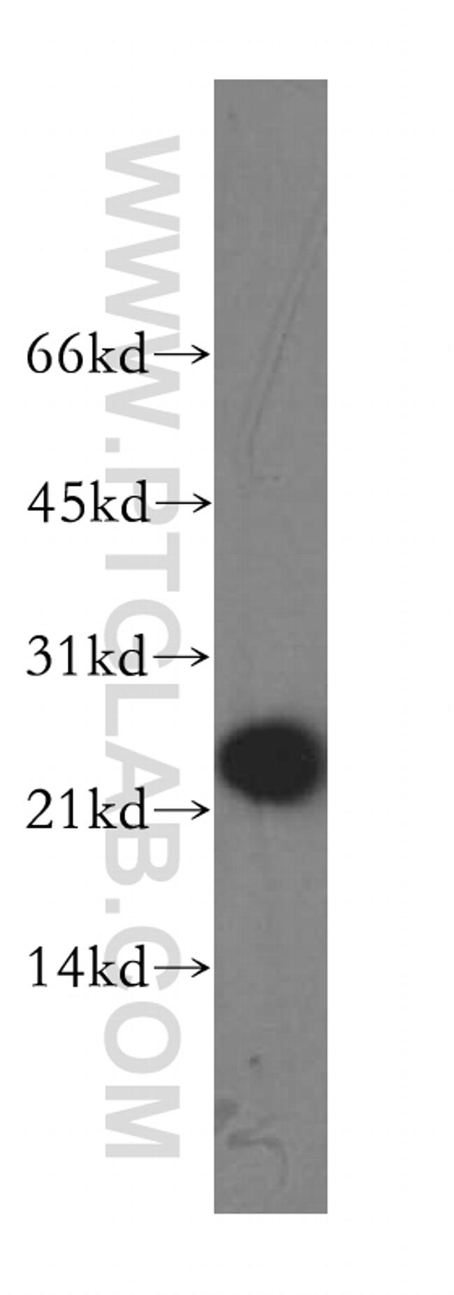 GPX7 Antibody in Western Blot (WB)