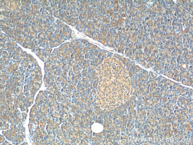 USP46 Antibody in Immunohistochemistry (Paraffin) (IHC (P))