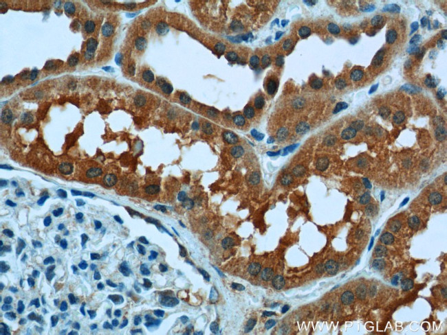 USP46 Antibody in Immunohistochemistry (Paraffin) (IHC (P))