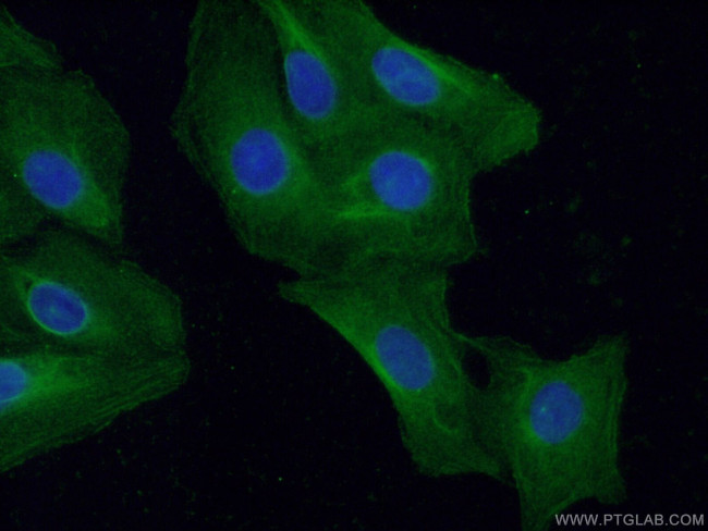 TNNC1 Antibody in Immunocytochemistry (ICC/IF)