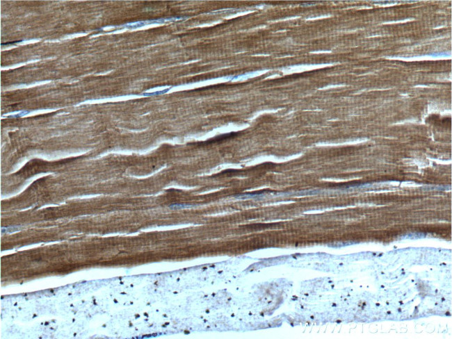 TNNC1 Antibody in Immunohistochemistry (Paraffin) (IHC (P))