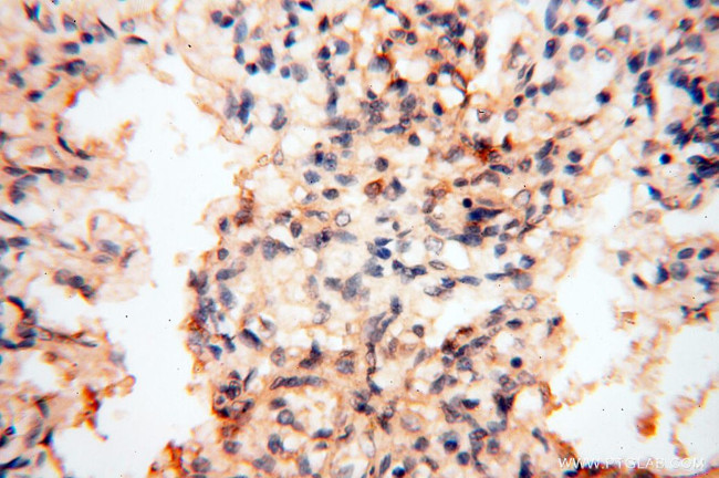 TNNC1 Antibody in Immunohistochemistry (Paraffin) (IHC (P))