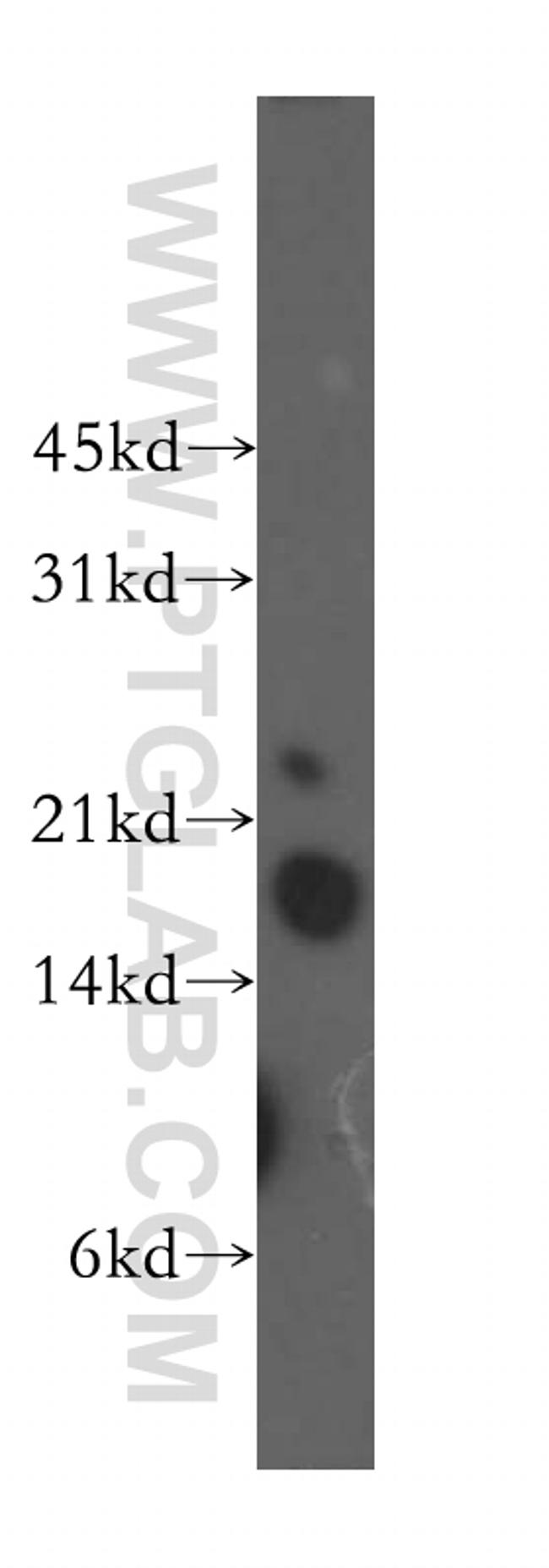 TNNC1 Antibody in Western Blot (WB)