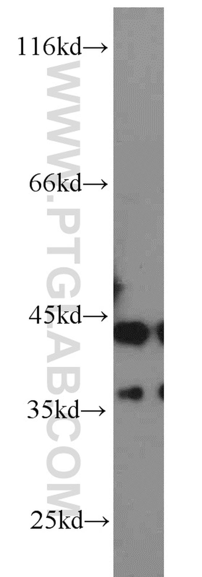 ATX3/ATXN3 Antibody in Western Blot (WB)