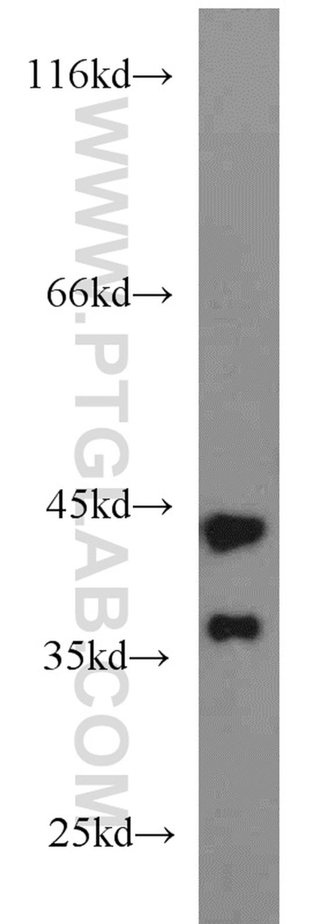 ATX3/ATXN3 Antibody in Western Blot (WB)