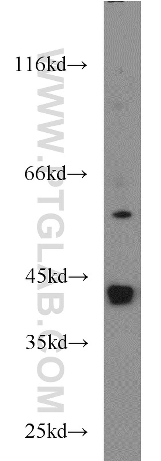 ATX3/ATXN3 Antibody in Western Blot (WB)