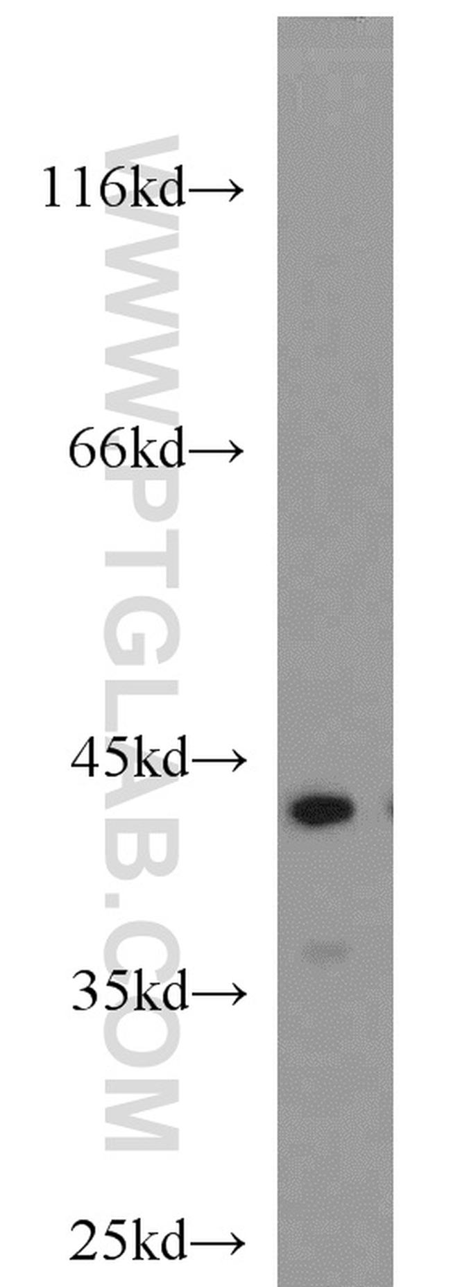 ATX3/ATXN3 Antibody in Western Blot (WB)